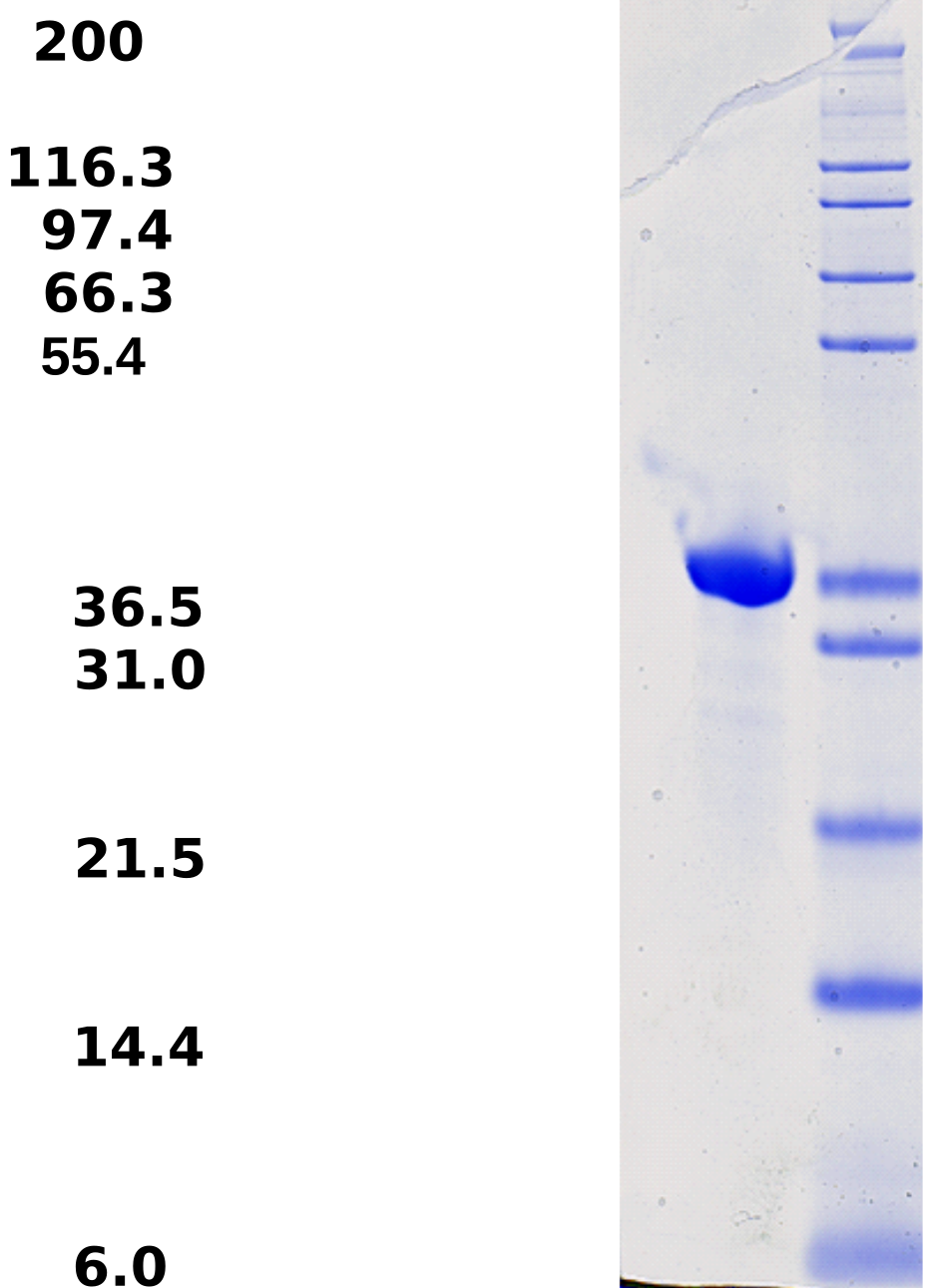 Proteros Product Image - Trk B (human) (504-822) 