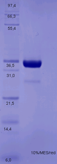 Proteros Product Image - TYK2 (human) (883-1182) (Q969A, E971A, K972A) 