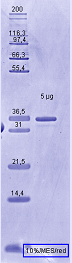 Proteros Product Image - B-Raf (human) (432-725) (V600E)