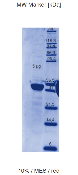 Proteros Product Image - c-Met (human) (1049-1349) (Y1234F, Y1235F) 