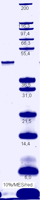 Proteros Product Image - eEF2Kinase (human) (2-370) 