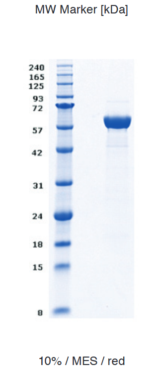 Proteros Product Image - EGFR Kinase, 696-1022 (human) 