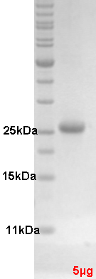 Proteros Product Image - HDM4 (human) (7-259) 