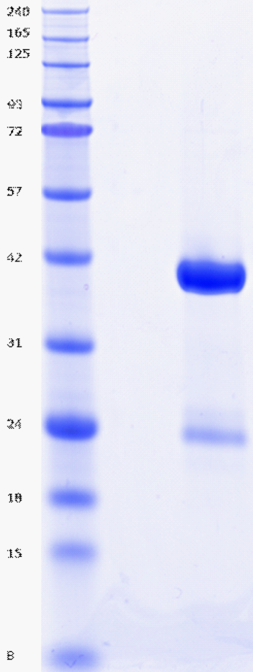 Proteros Product Image - NIK (human) (330-680)(S549D) 