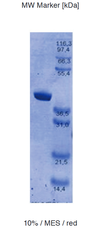 Proteros Product Image - PARP, Poly-(ADP)-Ribose-Polymerase (human) GST-(621-1011) 