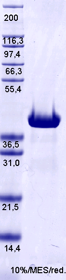 Proteros Product Image - PARP, Poly-(ADP)-Ribose-Polymerase (human) HIS-(621-1011)