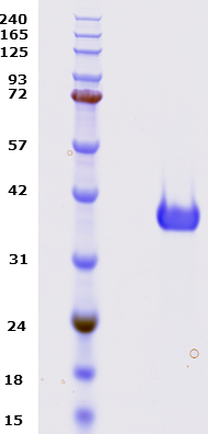 Proteros Product Image - PLK1 (human) (13-345) (T210V) 