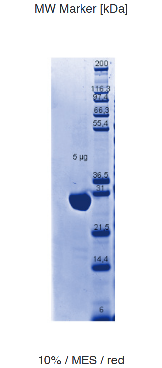Proteros Product Image - PLK4 (human) (6-271), T170D 