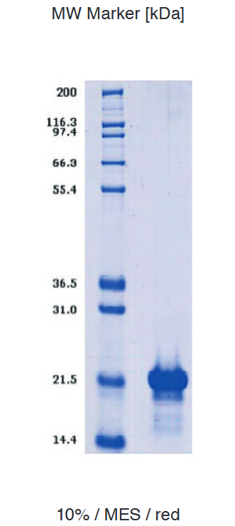 Proteros Product Image - RGS14 (human) (56-207)_RGS domain 