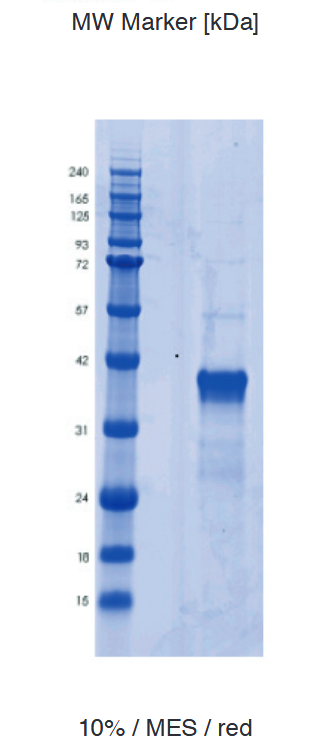Proteros Product Image - RGS14 (human) (302-566)_RBD domain 