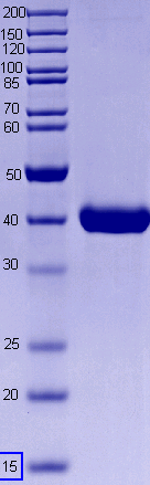 Proteros Product Image - SPHK-1 (human) (87-470) 