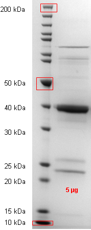 Proteros Product Image - STK33  (human) (94-423) 