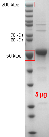 Proteros Product Image - STK33 (human) (94-514) 