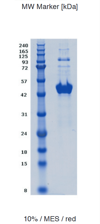 Proteros Product Image - TDO2 (human) (1-406) 