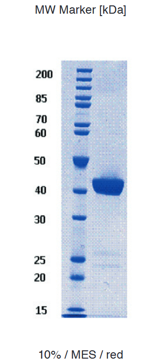 Proteros Product Image - USP8 (human) (734-1110) 