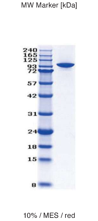 Proteros Product Image - Autotaxin (mouse) (36-858)