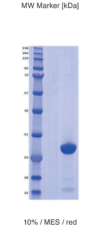 Proteros Product Image - PIV-5 (Simian virus 5) (1-122)