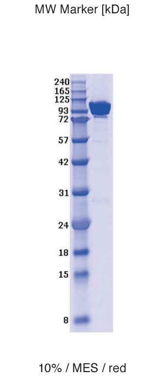 Proteros Product Image - RIG-1 (human) (1-925)