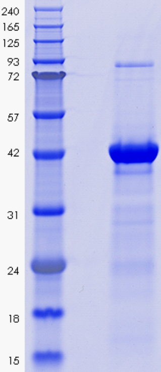 Proteros Product Image - TDO2 (human) (39-389) 