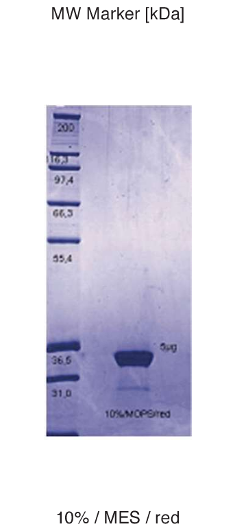 Proteros Product Image - ABL1 (human) (229-515)