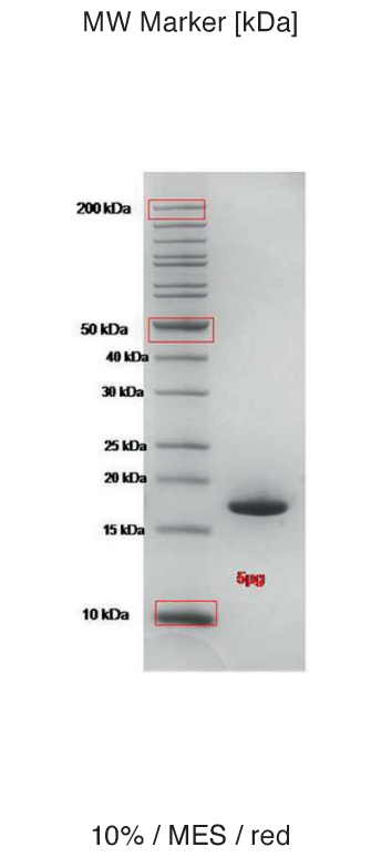Proteros Product Image - MMP-12 (human) (106-263) (F171D)