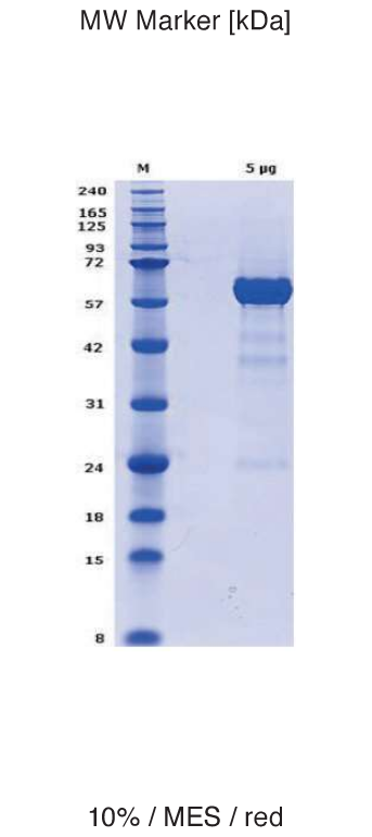 Proteros Product Image - PKB beta - AKT2 (human) (1-481)