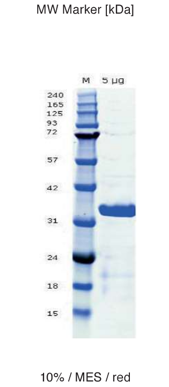 Proteros Product Image - C5 TE domain (human) (981-1306)