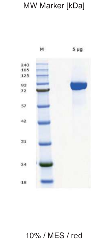 Proteros Product Image - HER2 (human) (1-629)