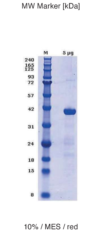 Proteros Product Image - PDE4D (human) (388-715)