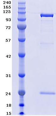 Proteros Product Image - PI3K delta (human) (1-1044) + p85 (human) (431-600)