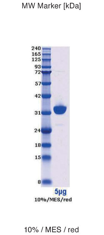 Proteros Product Image - UCHL1 (human) (1-223)