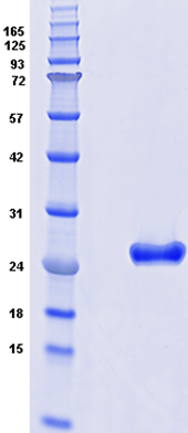 Proteros Product Image - NR2F6 (human) (163-404)