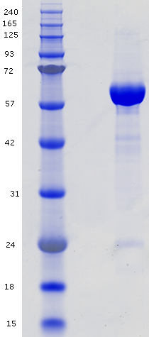 Proteros Product Image - PKB alpha - AKT1 (human) (1-480)