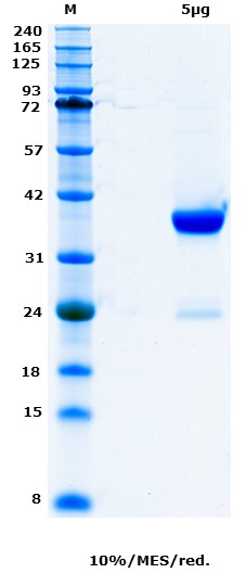 Proteros Product Image - EGFR Kinase, 696-1022 (human) 