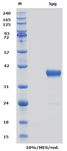 Proteros Product Image -  EGFR kinase (human) (696-1022) T790M, L858R, C797S